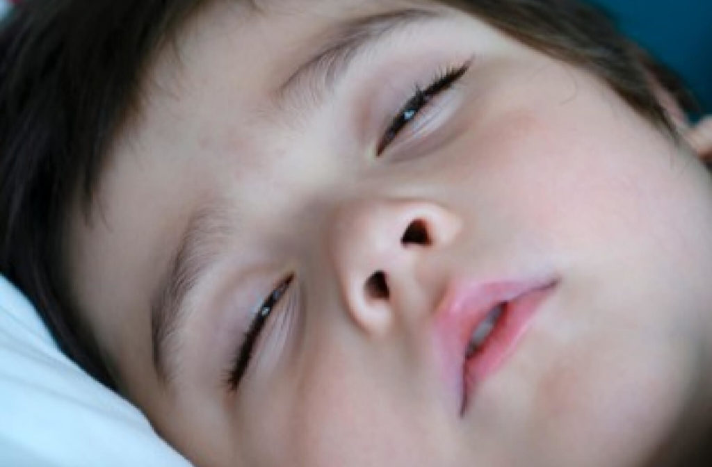 Close-up eyes of a little boy sleeping with his eyes half open causes dry eyes when you wake up.