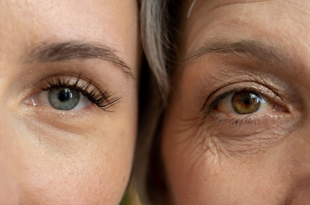 A close-up comparison of a young person's eyes and an older person's eyes