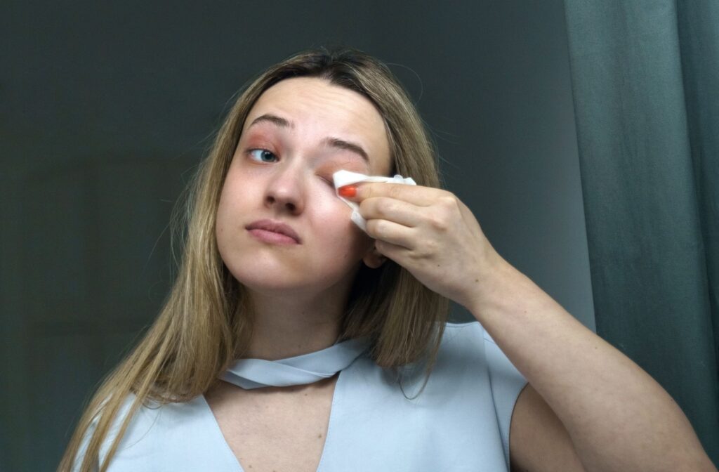 A person cleaning their eyelids to help manage symptoms of blepharitis